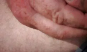 Halus, perawat, ditetapkan yang hangat video lucah sekolah prosedur rawatan untuk pesakit.
